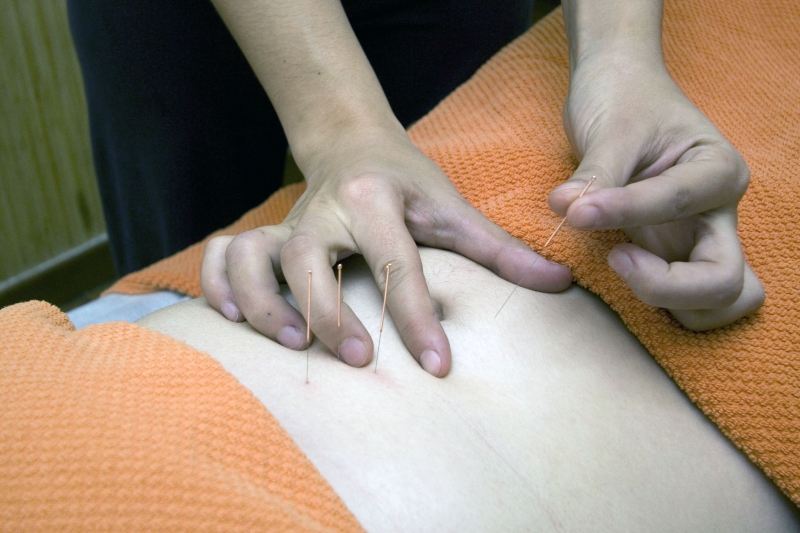 osteopathe-CAILLE-min_acupuncture-4175625